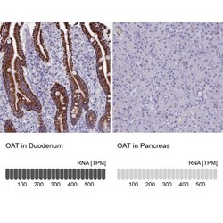 OAT Antibody, Novus Biologicals:Antibodies:Primary Antibodies